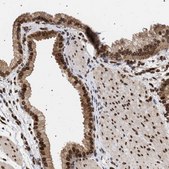 Anti-ING2 antibody produced in rabbit Prestige Antibodies® Powered by Atlas Antibodies, affinity isolated antibody, buffered aqueous glycerol solution