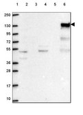 Anti-INPP5D antibody produced in rabbit Prestige Antibodies® Powered by Atlas Antibodies, affinity isolated antibody, buffered aqueous glycerol solution