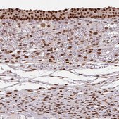 Anti-ELK1 antibody produced in rabbit Prestige Antibodies® Powered by Atlas Antibodies, affinity isolated antibody, buffered aqueous glycerol solution