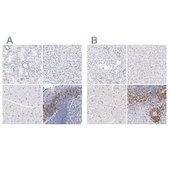 Anti-LAX1 antibody produced in rabbit Ab1, Prestige Antibodies® Powered by Atlas Antibodies, affinity isolated antibody, buffered aqueous glycerol solution