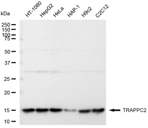 Anti TRAPPC2 Antibody, clone 23GB4230, Rabbit Monoclonal clone 23GB4230, recombinant rabbit monoclonal, expressed in HEK293 cells
