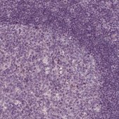 Anti-KIF6 antibody produced in rabbit Prestige Antibodies® Powered by Atlas Antibodies, affinity isolated antibody, buffered aqueous glycerol solution
