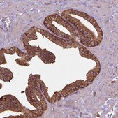 Anti-CORO1B antibody produced in rabbit Prestige Antibodies® Powered by Atlas Antibodies, affinity isolated antibody, buffered aqueous glycerol solution