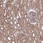 Anti-ITPR2 antibody produced in rabbit Prestige Antibodies® Powered by Atlas Antibodies, affinity isolated antibody, buffered aqueous glycerol solution
