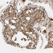 Anti-MRPS22 antibody produced in rabbit Prestige Antibodies® Powered by Atlas Antibodies, affinity isolated antibody, buffered aqueous glycerol solution, Ab2