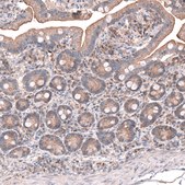 Anti-OSBP2 antibody produced in rabbit Prestige Antibodies® Powered by Atlas Antibodies, affinity isolated antibody, buffered aqueous glycerol solution