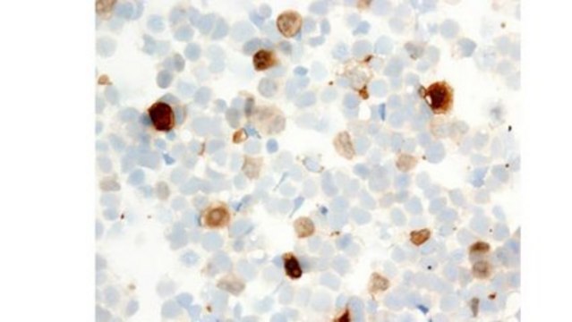 Anti-LMO2 (Rhombotin-2) Antibody, clone 299B clone 299B, from mouse