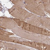 Anti-FZD2 antibody produced in rabbit Prestige Antibodies® Powered by Atlas Antibodies, affinity isolated antibody, buffered aqueous glycerol solution
