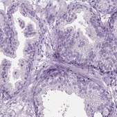 Anti-FAM92B antibody produced in rabbit Prestige Antibodies® Powered by Atlas Antibodies, affinity isolated antibody, buffered aqueous glycerol solution