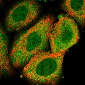 Anti-STRADA antibody produced in rabbit Prestige Antibodies® Powered by Atlas Antibodies, affinity isolated antibody, buffered aqueous glycerol solution