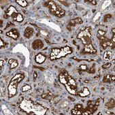 Anti-ATP6V0D1 antibody produced in rabbit Prestige Antibodies® Powered by Atlas Antibodies, affinity isolated antibody, buffered aqueous glycerol solution