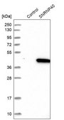 Anti-SNRNP40 antibody produced in rabbit Prestige Antibodies® Powered by Atlas Antibodies, affinity isolated antibody, buffered aqueous glycerol solution