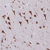 Anti-VAMP4 antibody produced in rabbit Prestige Antibodies® Powered by Atlas Antibodies, affinity isolated antibody, buffered aqueous glycerol solution