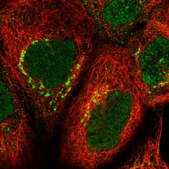 Anti-OSBP antibody produced in rabbit Prestige Antibodies® Powered by Atlas Antibodies, affinity isolated antibody, buffered aqueous glycerol solution