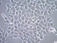 HOGヒト乏突起膠腫細胞株 HOG human oligodendroglioma cell line is a useful model to study the role of oligodendrocytes in neurodegenerative diseases.