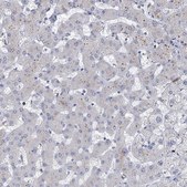 Anti-MYO7B antibody produced in rabbit Prestige Antibodies® Powered by Atlas Antibodies, affinity isolated antibody, buffered aqueous glycerol solution