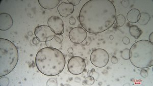 3dGRO® Human Liver Organoids (ID CS235474) Normal, Liver, Age: 57, Female, Mutation: None