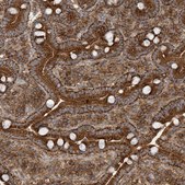 Anti-TRAIP antibody produced in rabbit Prestige Antibodies® Powered by Atlas Antibodies, affinity isolated antibody, buffered aqueous glycerol solution