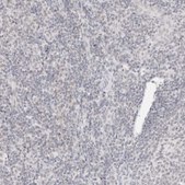 Anti-ITGA6 antibody produced in rabbit Prestige Antibodies® Powered by Atlas Antibodies, affinity isolated antibody, buffered aqueous glycerol solution
