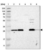Anti-AK2 antibody produced in rabbit Prestige Antibodies® Powered by Atlas Antibodies, affinity isolated antibody, buffered aqueous glycerol solution