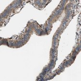 Anti-ALDH1A2 antibody produced in rabbit Prestige Antibodies® Powered by Atlas Antibodies, affinity isolated antibody, buffered aqueous glycerol solution