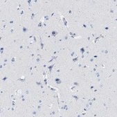 Anti-IL16 antibody produced in rabbit Prestige Antibodies® Powered by Atlas Antibodies, affinity isolated antibody, buffered aqueous glycerol solution