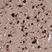 抗EIF4ENIF1抗体 ウサギ宿主抗体 Ab2, Prestige Antibodies® Powered by Atlas Antibodies, affinity isolated antibody, buffered aqueous glycerol solution