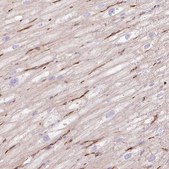 Anti-EHD3 antibody produced in rabbit Prestige Antibodies® Powered by Atlas Antibodies, affinity isolated antibody, buffered aqueous glycerol solution