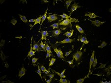 OSUMMER.4 Mouse NRAS-Mutant Melanoma Cell Line