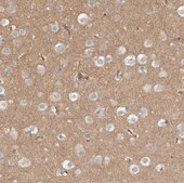 Anti-MPRIP antibody produced in rabbit Prestige Antibodies® Powered by Atlas Antibodies, affinity isolated antibody, buffered aqueous glycerol solution, Ab2