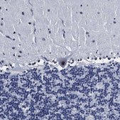 Anti-PRPF4B antibody produced in rabbit Prestige Antibodies® Powered by Atlas Antibodies, affinity isolated antibody, buffered aqueous glycerol solution