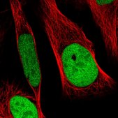 Anti-RCC1 antibody produced in rabbit Prestige Antibodies® Powered by Atlas Antibodies, affinity isolated antibody, buffered aqueous glycerol solution, ab1