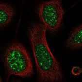 Anti-CRIP3 antibody produced in rabbit Prestige Antibodies® Powered by Atlas Antibodies, affinity isolated antibody, buffered aqueous glycerol solution