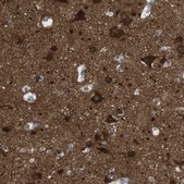 Anti-RTN3 antibody produced in rabbit Prestige Antibodies® Powered by Atlas Antibodies, affinity isolated antibody, buffered aqueous glycerol solution