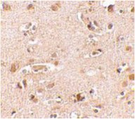 Anti-NANOS2 Antibody from rabbit, purified by affinity chromatography