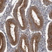 Anti-STAM2 antibody produced in rabbit Prestige Antibodies® Powered by Atlas Antibodies, affinity isolated antibody, buffered aqueous glycerol solution