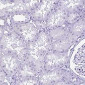 Anti-KRT10 antibody produced in rabbit Prestige Antibodies® Powered by Atlas Antibodies, affinity isolated antibody, buffered aqueous glycerol solution