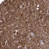 Anti-PTGR1 antibody produced in rabbit Prestige Antibodies® Powered by Atlas Antibodies, affinity isolated antibody, buffered aqueous glycerol solution