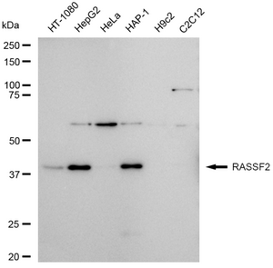 Anti RASSF2 Antibody, clone 23GB4605, Rabbit Monoclonal clone 23GB4605, recombinant rabbit monoclonal, expressed in HEK293 cells