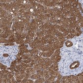Anti-UGP2 antibody produced in rabbit Prestige Antibodies® Powered by Atlas Antibodies, affinity isolated antibody, buffered aqueous glycerol solution