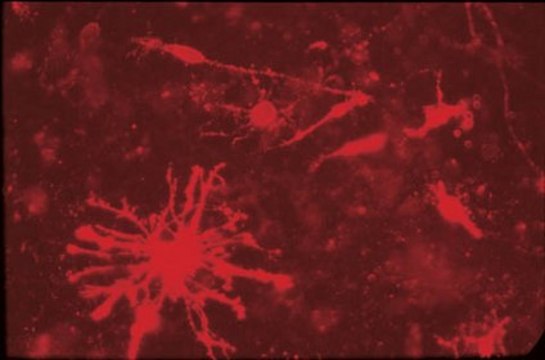 Anti-Chondroitin Sulfate Proteoglycan Antibody, Core Protein Epitope, clone Cat-315 ascites fluid, clone Cat-315, Chemicon&#174;