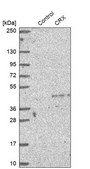 Anti-CRX antibody produced in rabbit Prestige Antibodies® Powered by Atlas Antibodies, affinity isolated antibody, buffered aqueous glycerol solution