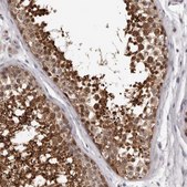 Anti-MED8 antibody produced in rabbit Prestige Antibodies® Powered by Atlas Antibodies, affinity isolated antibody, buffered aqueous glycerol solution, ab2