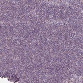 Anti-SLC1A7 antibody produced in rabbit Prestige Antibodies® Powered by Atlas Antibodies, affinity isolated antibody, buffered aqueous glycerol solution