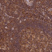 Anti-STOML1 antibody produced in rabbit Prestige Antibodies® Powered by Atlas Antibodies, affinity isolated antibody, buffered aqueous glycerol solution