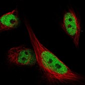 Anti-ARID1B antibody produced in rabbit Prestige Antibodies® Powered by Atlas Antibodies, affinity isolated antibody, buffered aqueous glycerol solution