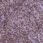 Anti-AKAP17A antibody produced in rabbit Prestige Antibodies® Powered by Atlas Antibodies, affinity isolated antibody, buffered aqueous glycerol solution