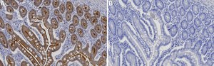 Anti-MYH14/Myosin-14 Antibody, clone 2B4 ZooMAb® Rabbit Monoclonal recombinant, expressed in HEK 293 cells