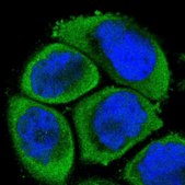 Anti-MAP3K4 antibody produced in rabbit Prestige Antibodies® Powered by Atlas Antibodies, affinity isolated antibody, buffered aqueous glycerol solution