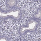 Anti-ZBTB32 Prestige Antibodies® Powered by Atlas Antibodies, affinity isolated antibody